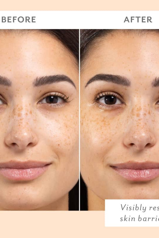 Cozy Comforts Soothing & Protecting Skincare Essential Kit | Patchology