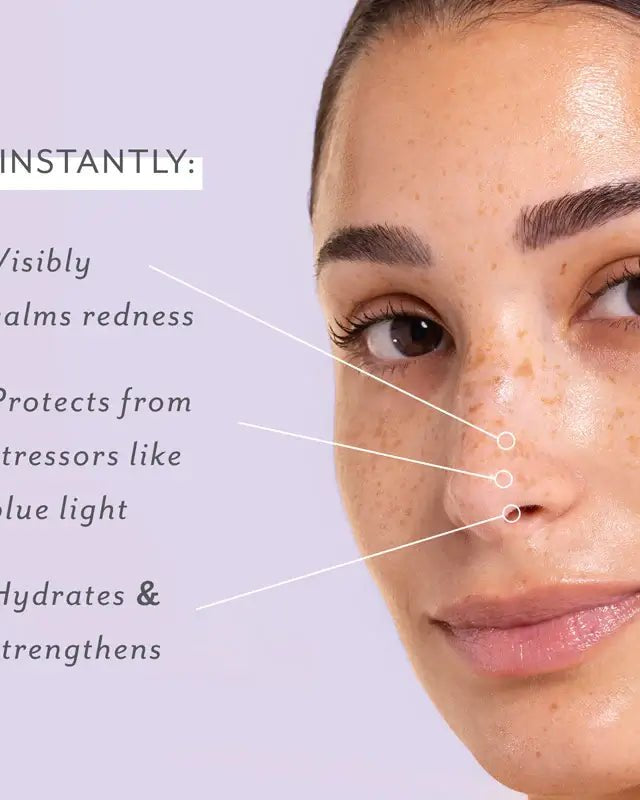 Patchology Skin Remedy Calm and Protect Micro Mist