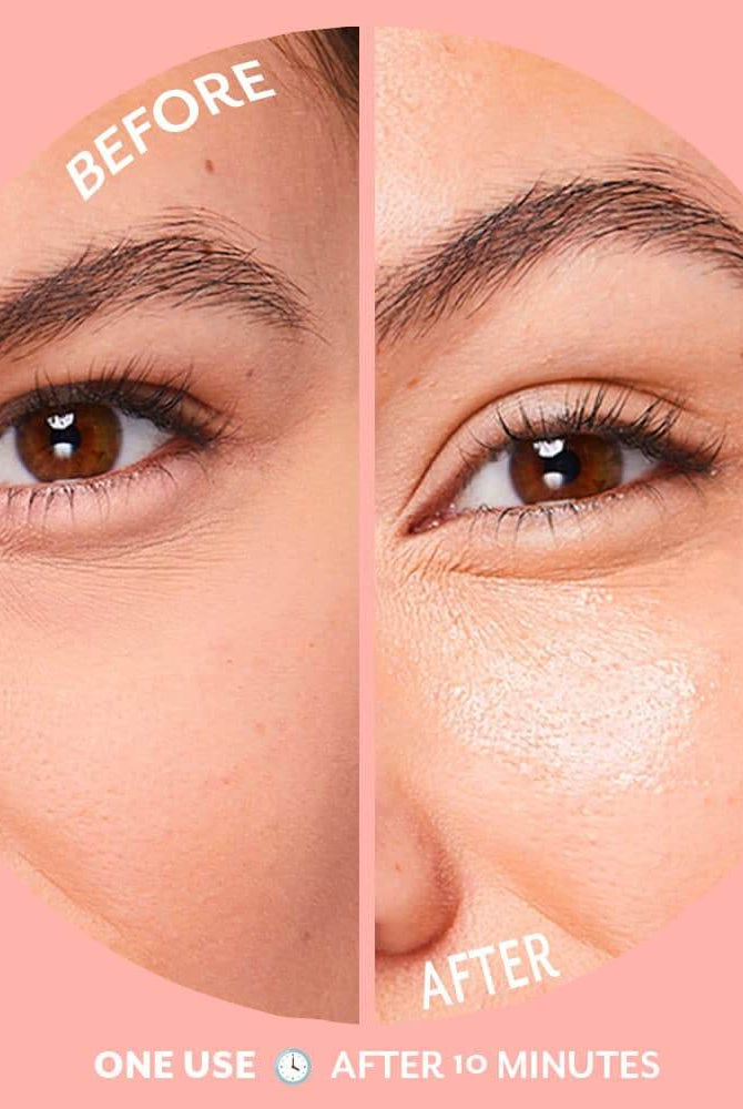 Serve Chilled Bubbly Eye Gels Brightening | Patchology (Single Pair) - Patchology - Cloud Nine Pajamas