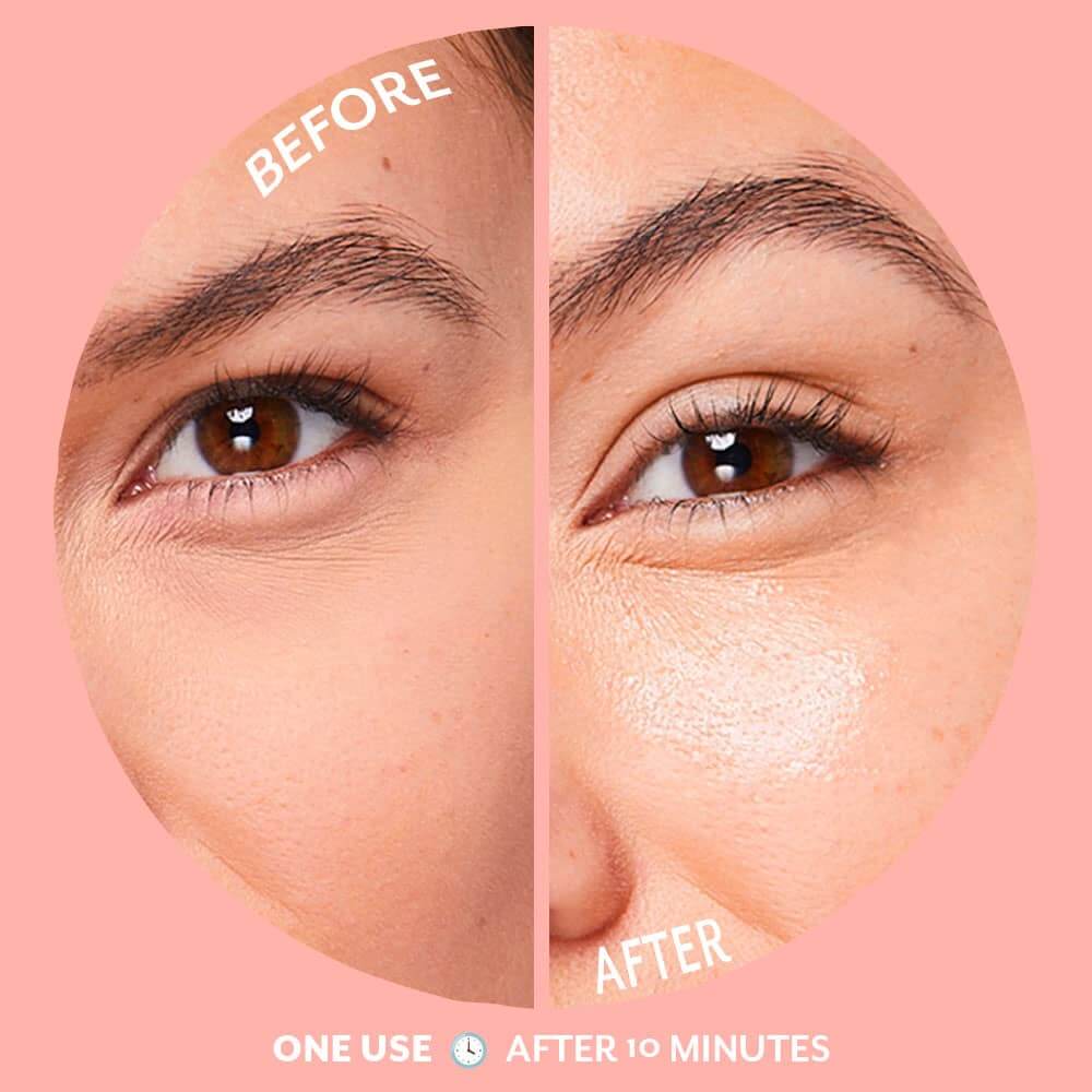 Serve Chilled Bubbly Eye Gels Brightening | Patchology (Single Pair) - Patchology - Cloud Nine Pajamas